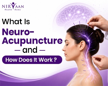 what-is-neuro-acupuncture-and-how-does-it-work